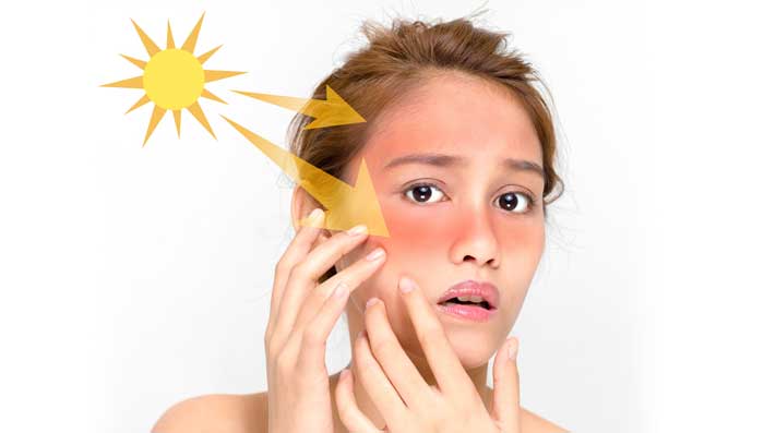 Remove Sun Tan With Home Remedies